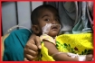 হামের উপসর্গে ২৪ ঘণ্টায় ৬ জনের মৃত্যু, আক্রান্ত ১ হাজার ৩৬৬
